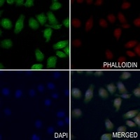 Anti-MTA1 Antibody
