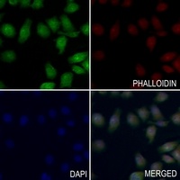 MTA1 antibody