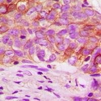 mTOR Antibody