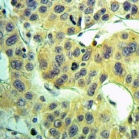Anti-NDUFS3 Antibody