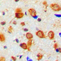 Anti-NEFL Antibody