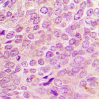 Anti-Merlin Antibody