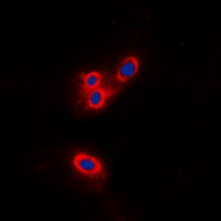 Anti-Merlin Antibody