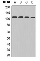 NF-kappaB p105 Rabbit Polyclonal Antibody