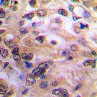 NF-kappaB p105 Rabbit Polyclonal Antibody