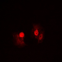 NF-kappaB p105 Rabbit Polyclonal Antibody