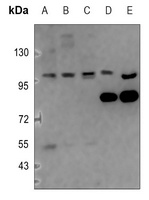 NF-kappaB p105/p50 Rabbit Polyclonal Antibody