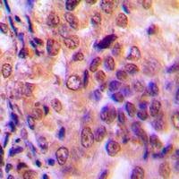 NF-kappaB p105/p50 Rabbit Polyclonal Antibody