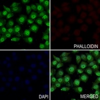 NF-kappaB p105/p50 Rabbit Polyclonal Antibody