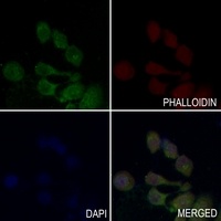 Anti-GPR120 Antibody