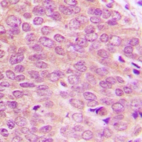 Anti-TOPK (Phospho-T9) Antibody