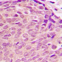 Anti-PDK2 Antibody
