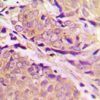 Anti-PFKM Antibody