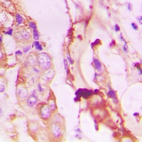 Anti-PI3K p85 alpha/p55 gamma (Phospho-Y467/199) Antibody