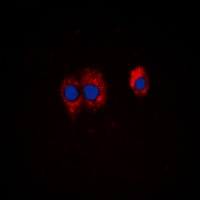 Anti-PI3K p85 alpha/p55 gamma (Phospho-Y467/199) Antibody