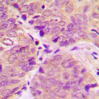 Anti-DARPP32 (Phospho-T34) Antibody