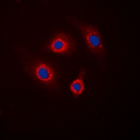 Anti-DARPP32 (Phospho-T34) Antibody