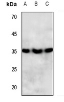 PPT Rabbit Polyclonal Antibody