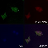 PPT1 antibody