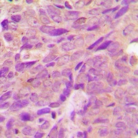 Anti-AMPK beta 1 Antibody
