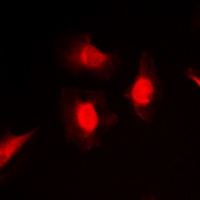 Anti-PKC iota/zeta (Phospho-T412/410) Antibody