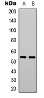 PTEN Rabbit Polyclonal Antibody