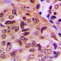 PTEN Rabbit Polyclonal Antibody