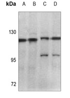 Focal Adhesion Kinase Rabbit Polyclonal Antibody