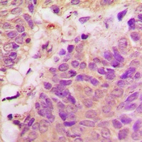 Focal Adhesion Kinase Rabbit Polyclonal Antibody