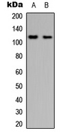 PYK2 Rabbit Polyclonal Antibody