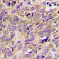 PYK2 Rabbit Polyclonal Antibody