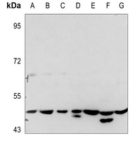 PTX3 Antibody