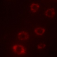 PTX3 antibody