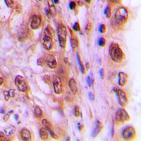 Anti-c-Rel (Phospho-S503) Antibody