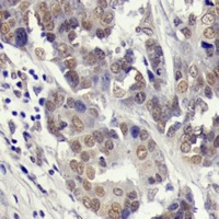 Anti-YAP1 (Phospho-S127) Antibody