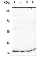 RIMKLB Antibody