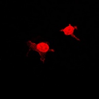 Anti-MSK1 (Phospho-S376) Antibody