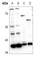 RRM2B Antibody