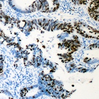 Anti-RUNX1 (Phospho-S276) Antibody
