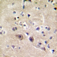 RYR2 antibody