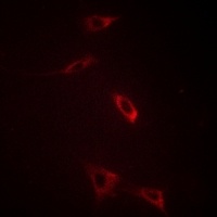 RYR2 antibody