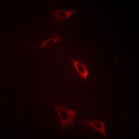 Anti-Ryanodine Receptor 2 Antibody