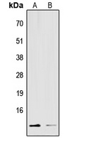 S100A16 Antibody