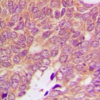 S100A16 Antibody
