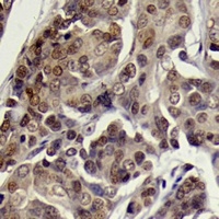 SGK1 (Phospho-S78) antibody