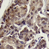 Anti-SGK1 (Phospho-S78) Antibody