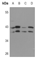 SIRT2 Rabbit Polyclonal Antibody