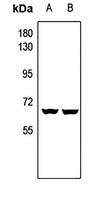 CAT4 Rabbit Polyclonal Antibody