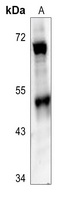 SMYD2 Rabbit Polyclonal Antibody