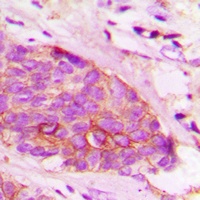 alpha Synuclein antibody